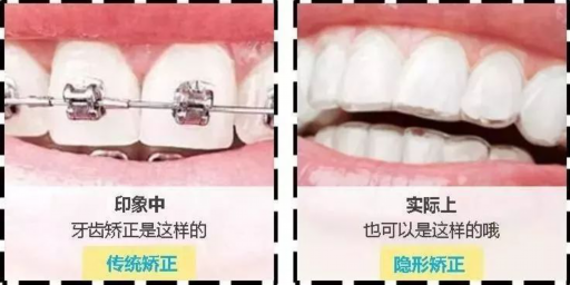 2025郑州合金烤瓷牙整形榜单前10强牙科医院(郑州鼎植口腔医院多方面上线可查)